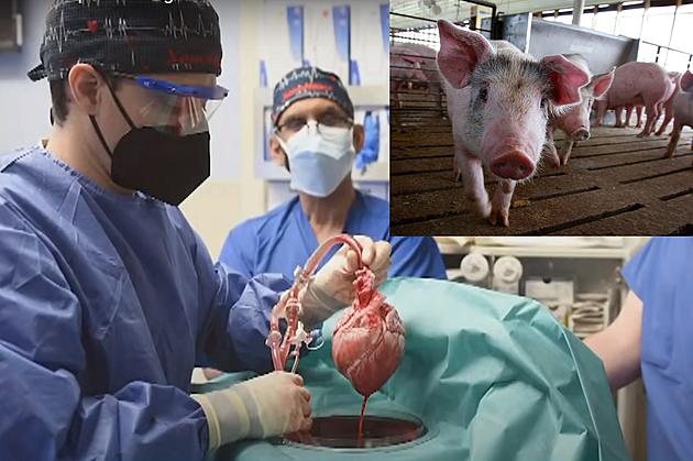 First Ever Successful Pig Heart Transplant Will Change How You Feel About Pork
