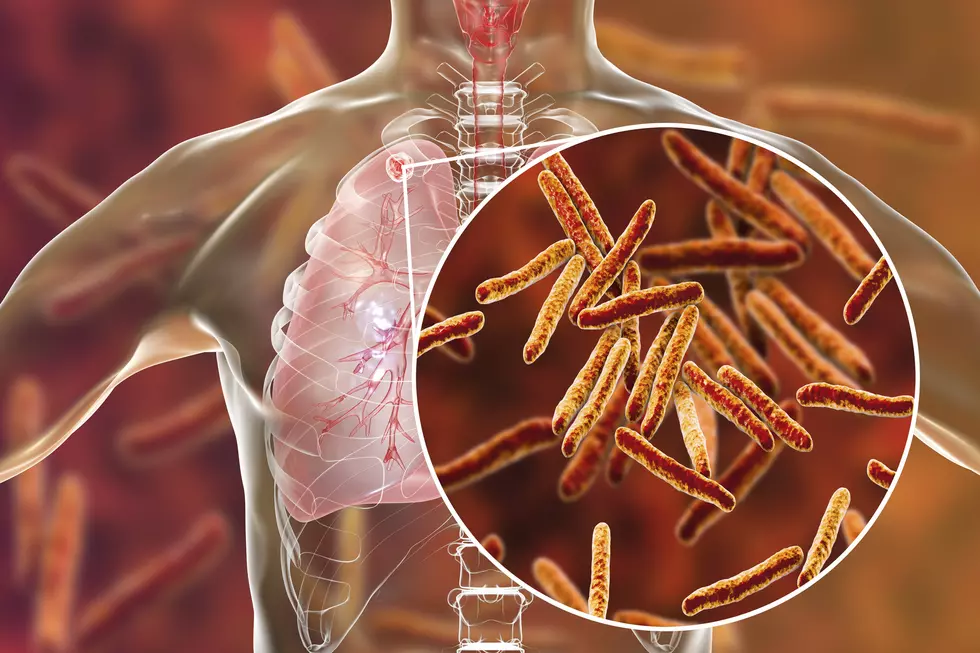 Hudson Valley Student Diagnosed with Tuberculosis