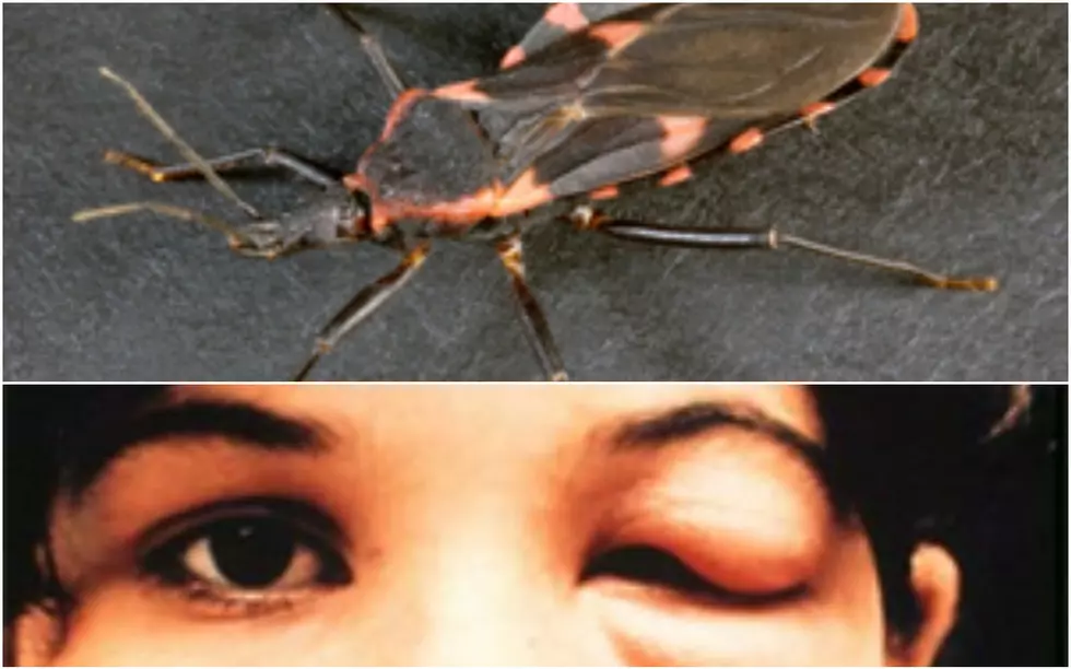 Deadly Face-Sucking &#8216;Kissing Bug&#8217; Likely Headed To New York