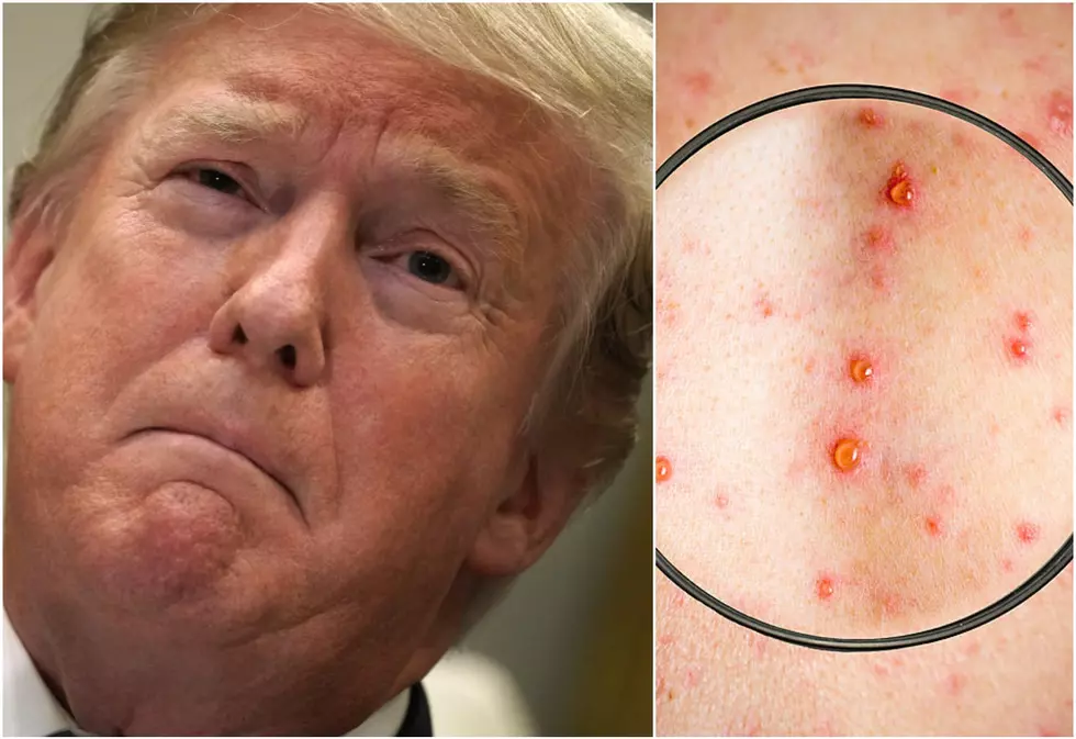 Can President Trump Stop the Hudson Valley Measles Outbreak?