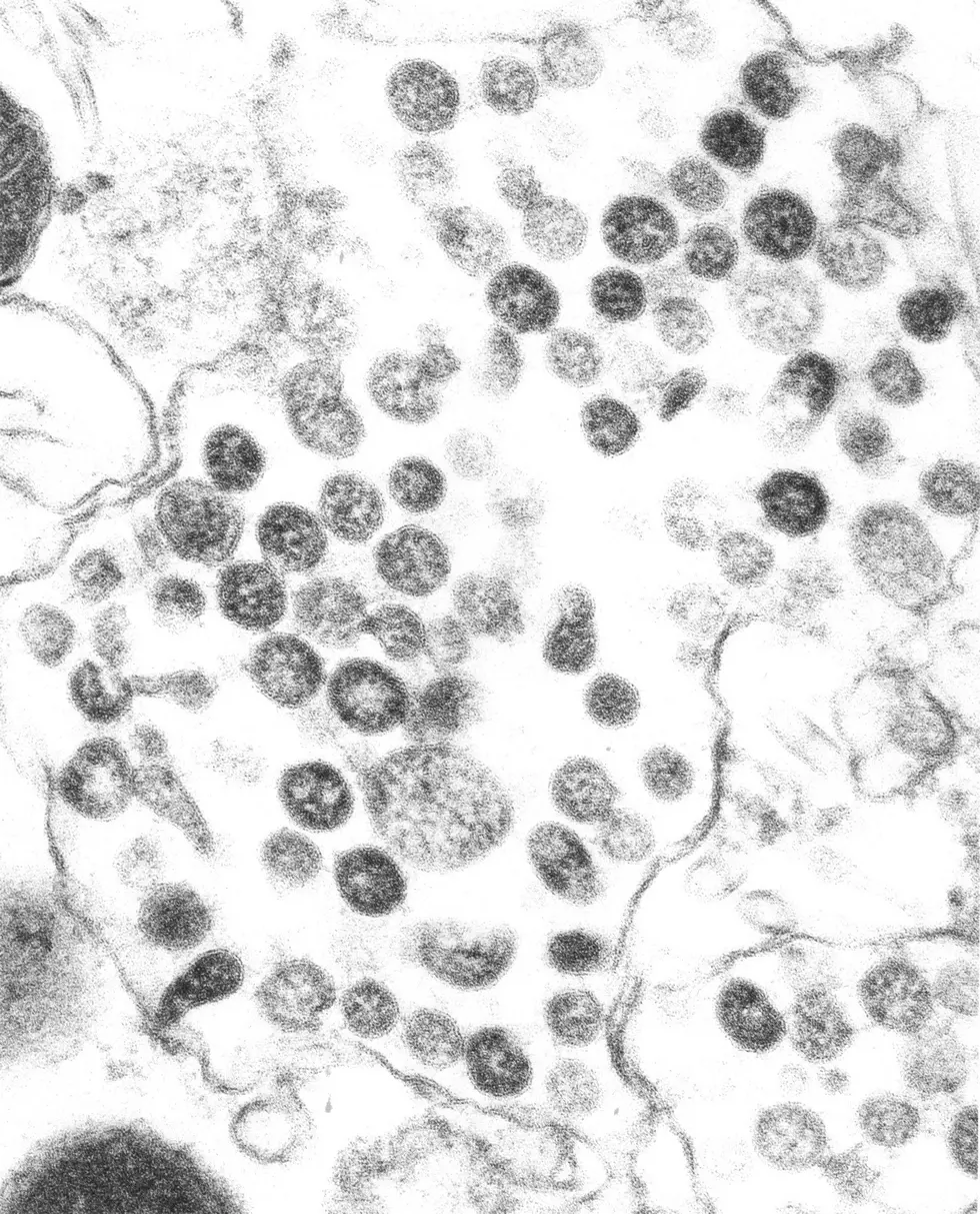 Number of Confirmed Coronavirus Cases in New York as of March 23