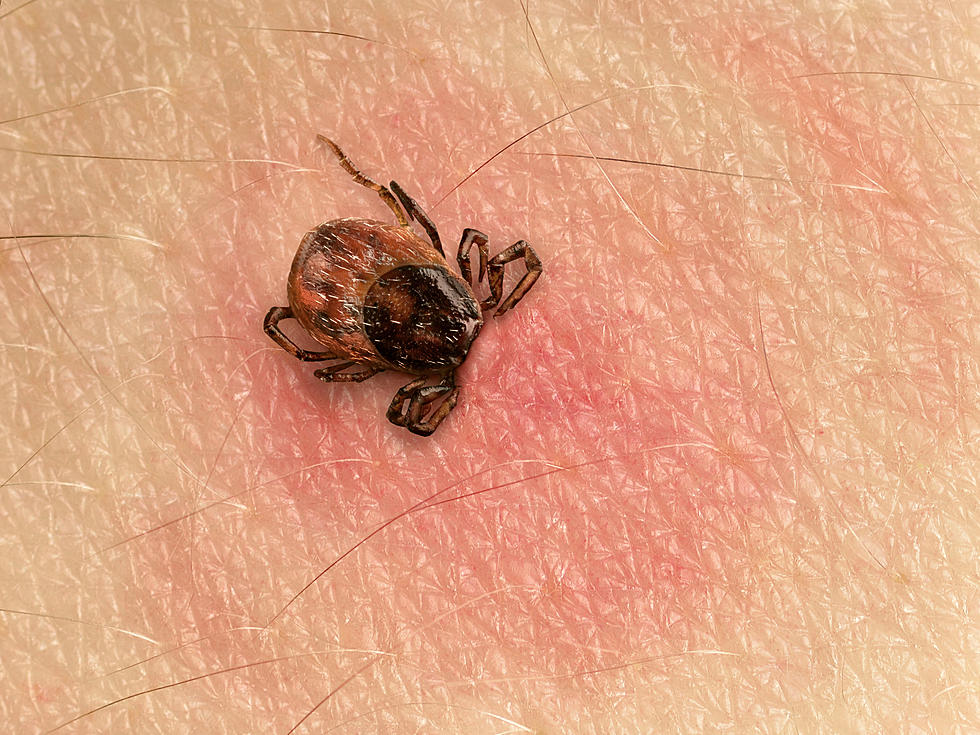 New York State Now Home To 2nd Most Tick Cases In Nation