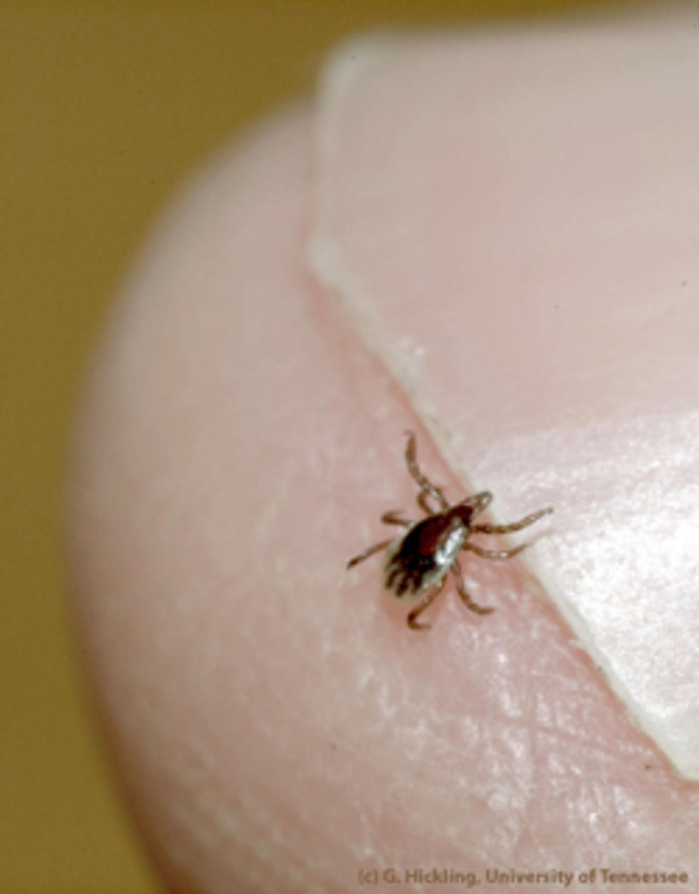 New Sometimes Fatal Tick Disease Confirmed In New York State