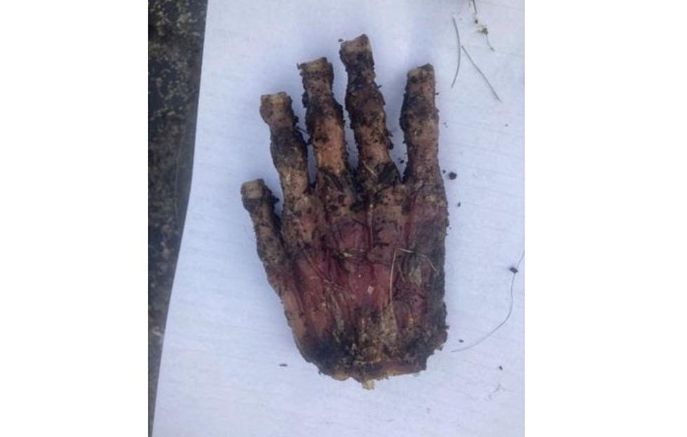 New York State Investigates After &#8216;Suspected Human Hand&#8217; Found