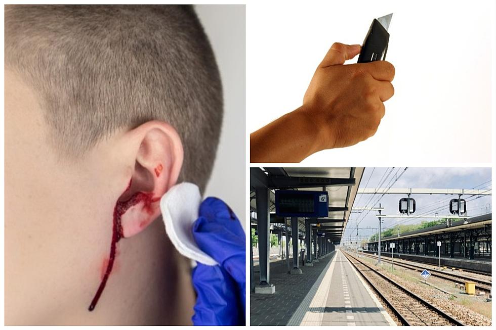 Man Gets Ear Nearly Cut Off At Train Station In New York