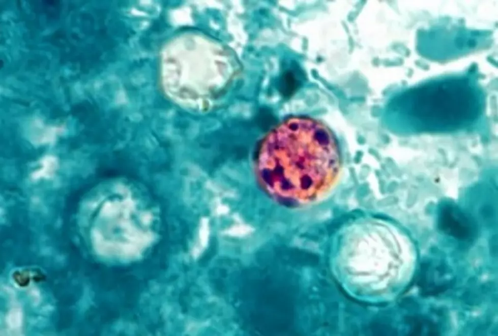 NY Alert: FDA Looking For Source Of New Cyclosporiasis Outbreak