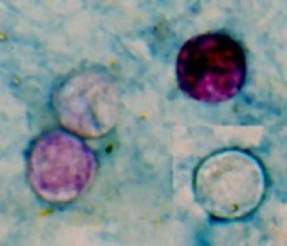 New York’s Growing Parasitic Diarrhea Outbreak Nears 1,000 Cases