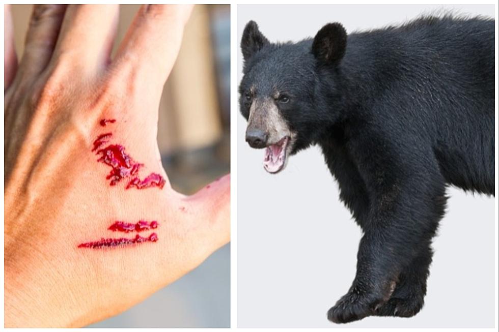 Potentially Rabid Bear Attacks Child In Hudson Valley, New York