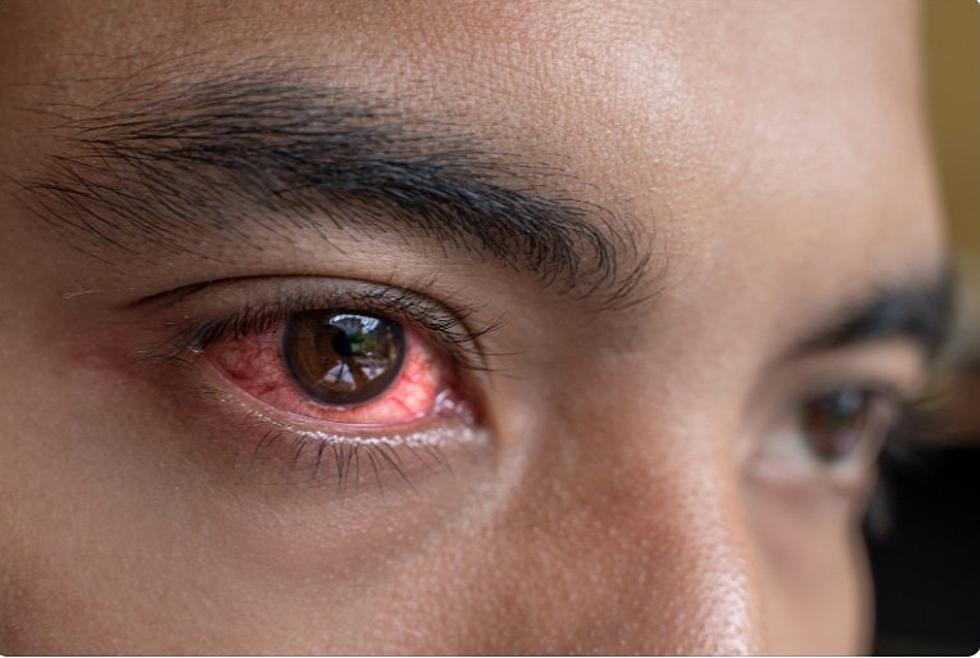 Eye Drops Sold In New York May Cause ‘Life-Threatening Infection’