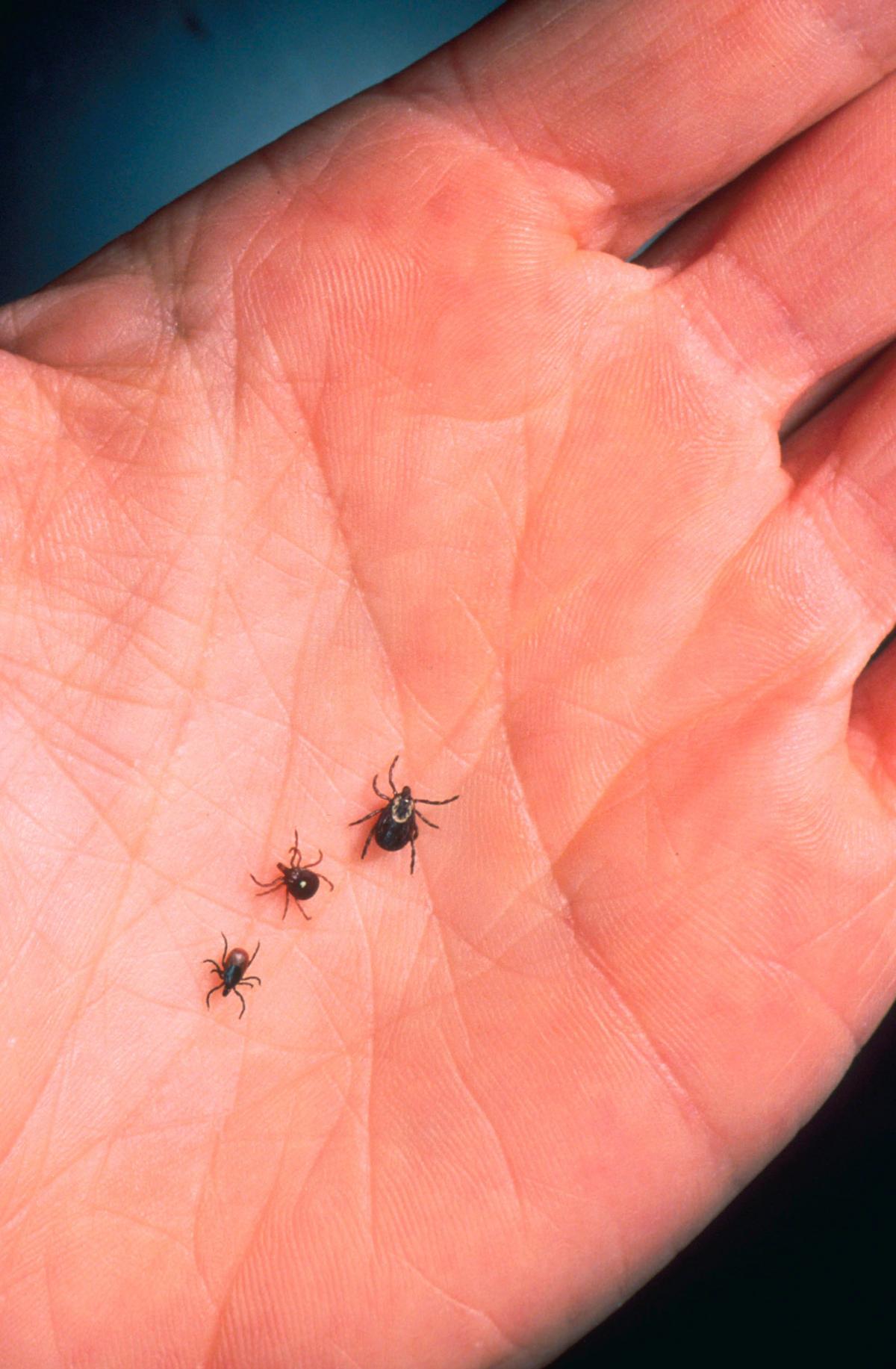 Upstate New York Man Shocked By 20 Deadly Ticks