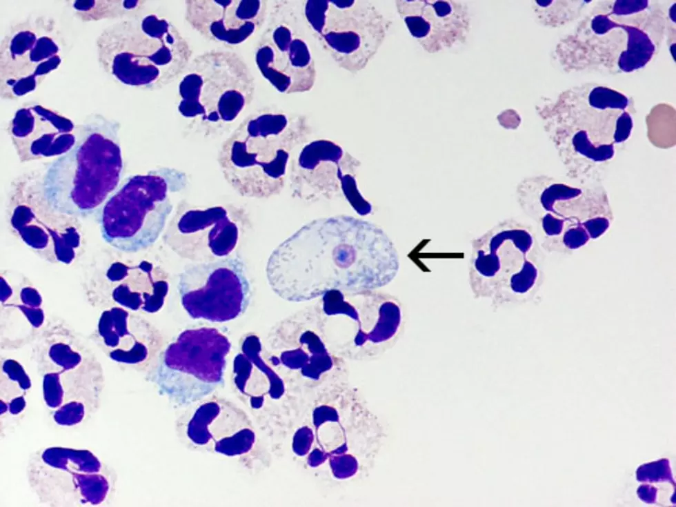 Deadly Brain-Eating Amoeba Season Returns To New York