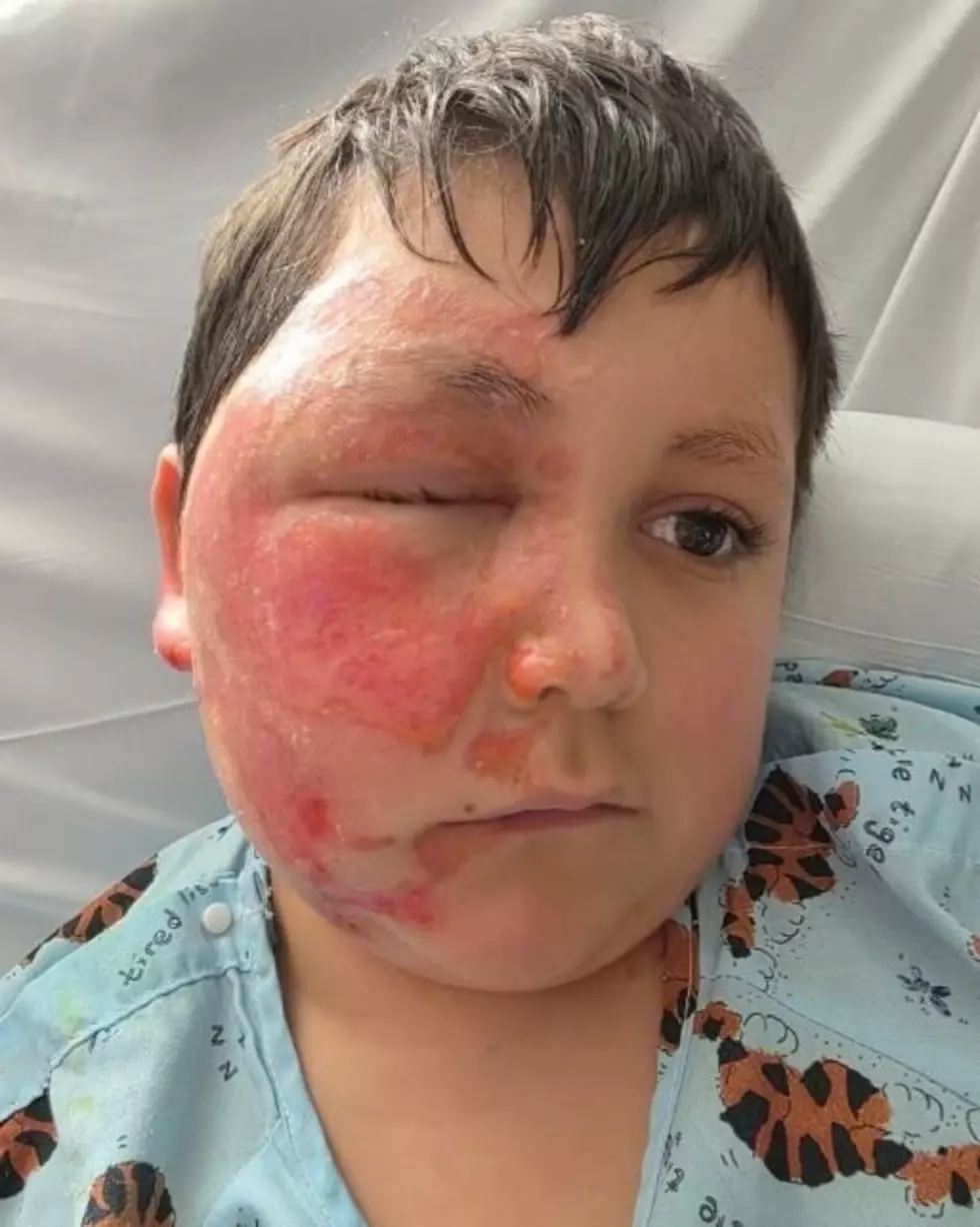 Viral Toy Trend Is Sending New York Children To Hospitals