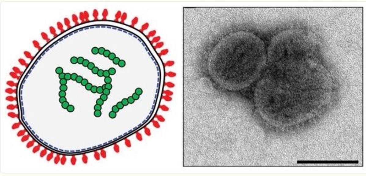 What is Bourbon Virus? Origin and Transmission
