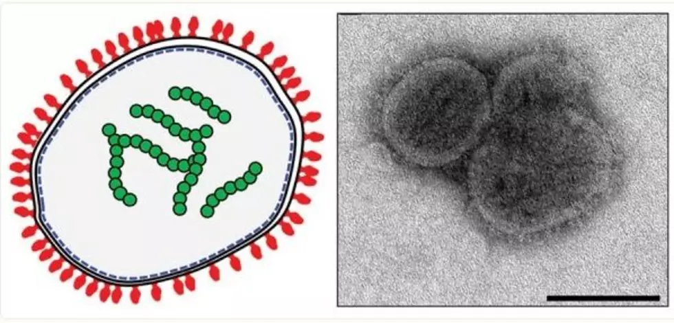 Rare, Untreatable Fatal Virus Found In New York For The 1st Time