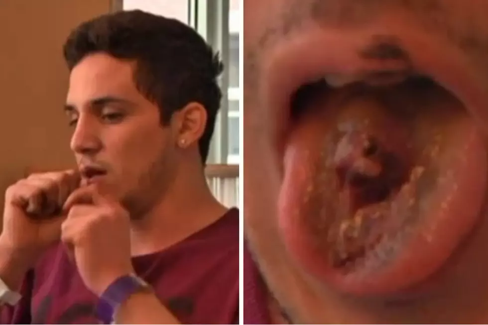 Vaping Explosion Rips Hole in Man's Tongue + Knocks Out Teeth [VIDEO]