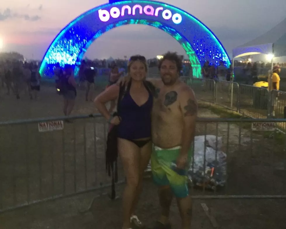 AJ Is Busted Up from Bonnaroo [WARNING: Gross Bruise Photos]