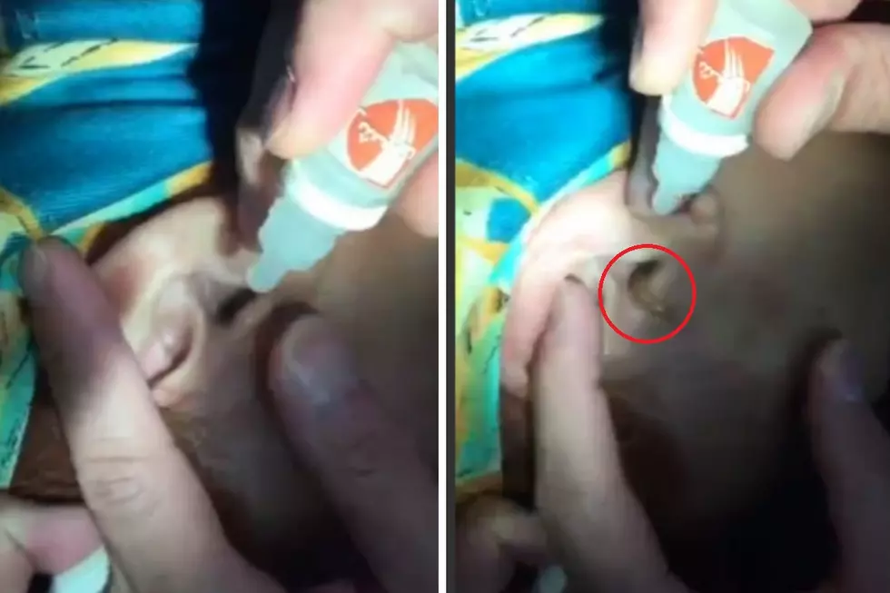 You&#8217;ll Never Believe What Came Out of This Girl&#8217;s Ear [VIDEO]