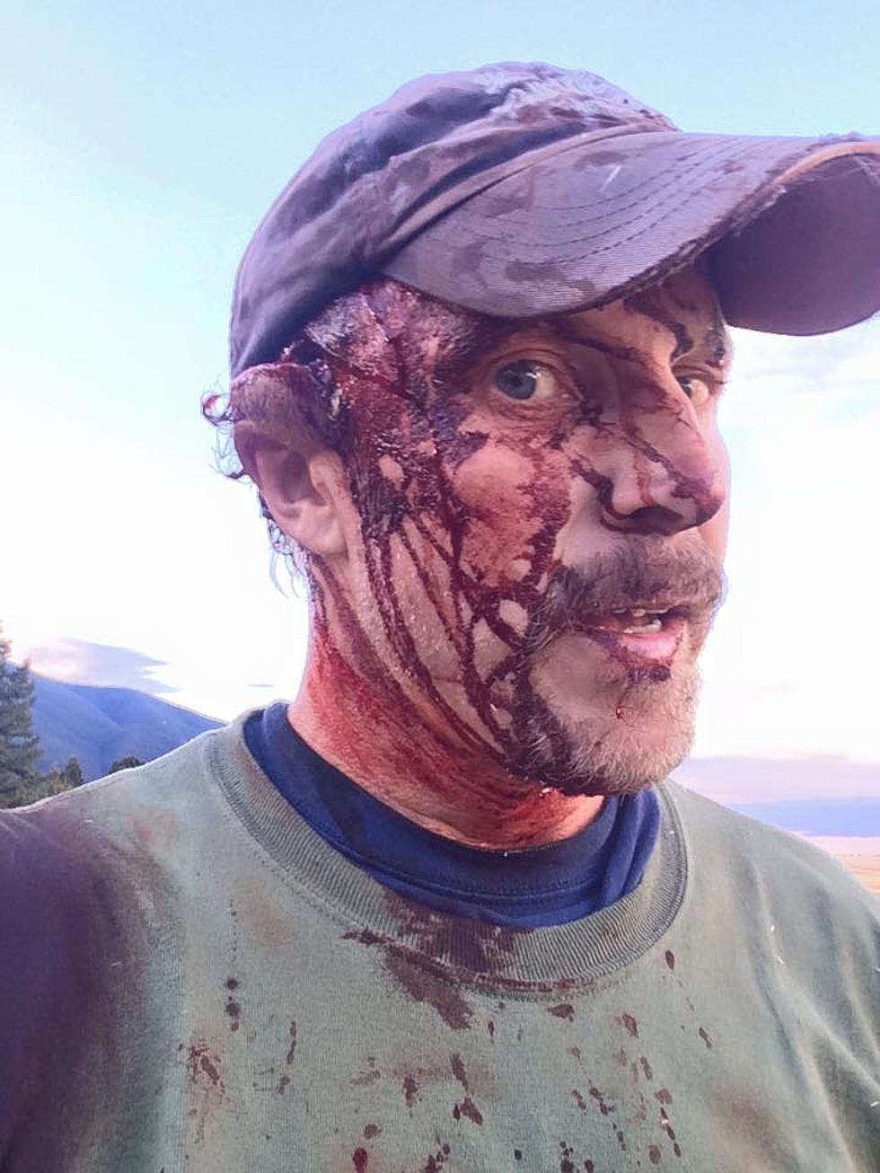 Guy Gets Attacked by a Bear TWICE in One Day, Posts Video [WARNING: Graphic]