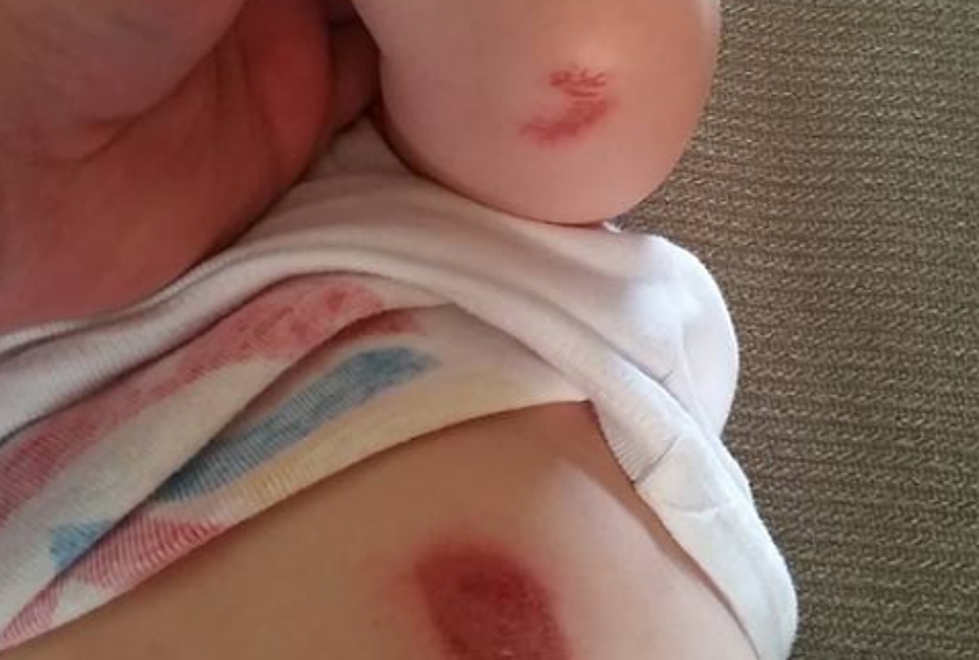 Davison Dad Claims Daughter Has Burns from Flint Store’s Shopping Carts