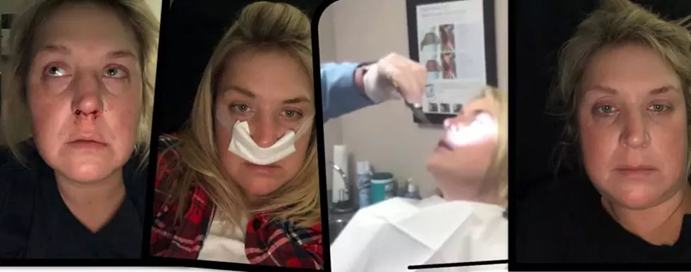 Watch AJ Have the Stents Removed from Her Nose [VIDEO]