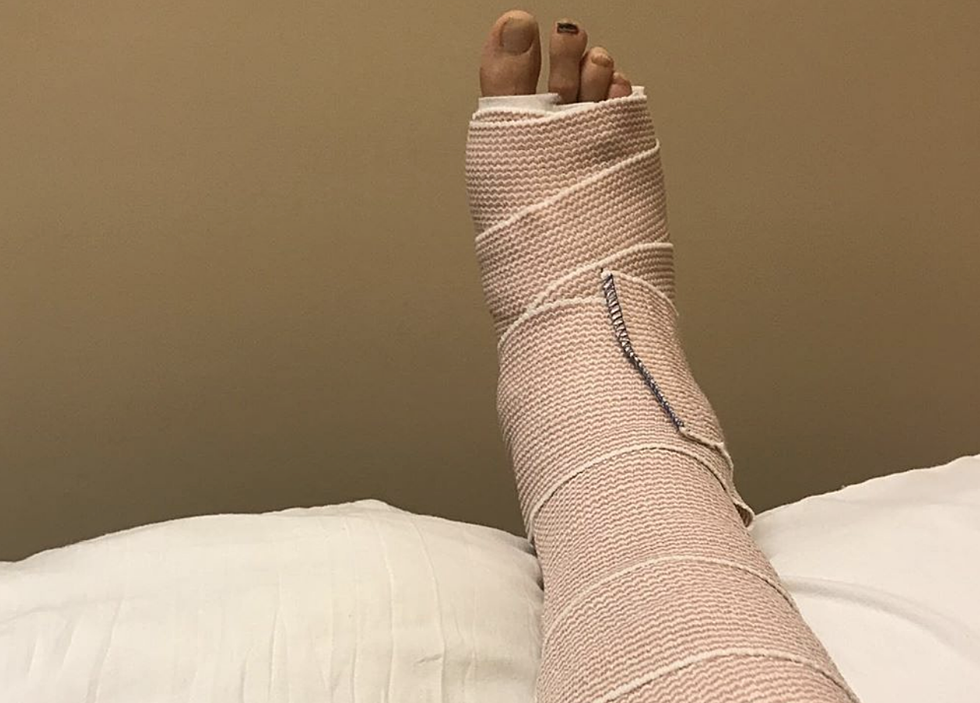 A Pro Runner Broke his Ankle in a Pothole During the Crim 