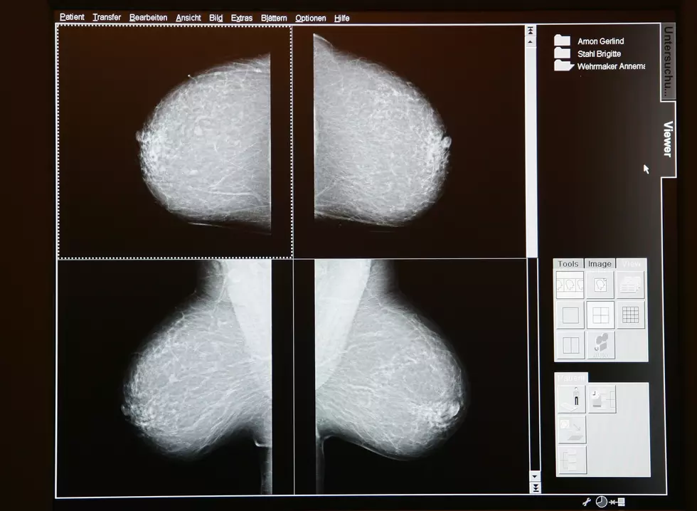 McLaren Flint Giving Free Mammograms to Women in Need – The Good News