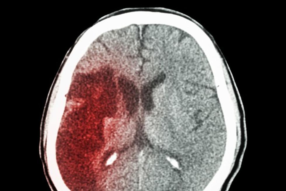 Knowing the Warning Signs of a Stroke Can Save Your Life