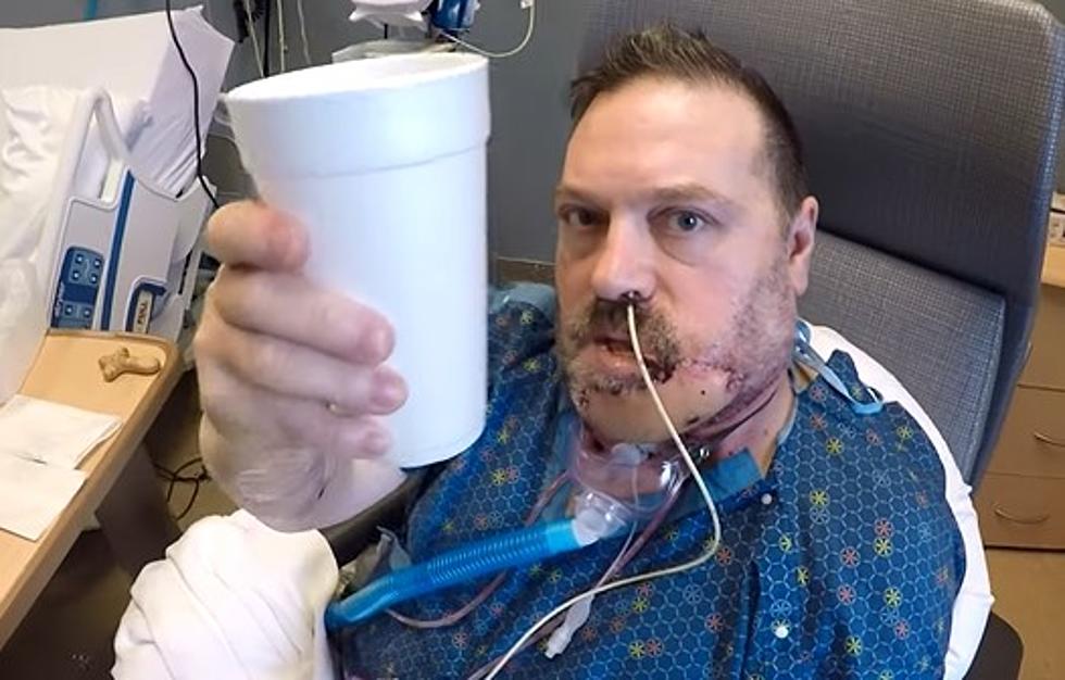 Genesee County Man Shares His Painful Story of Oral Cancer