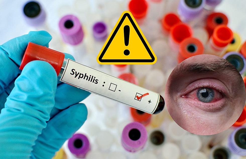 Beware! Kalamazoo Women Being Warned Of Eye Syphilis Outbreak