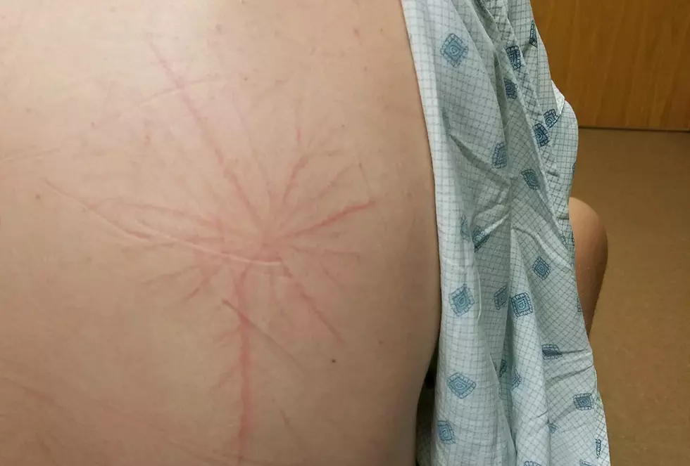 MN Teen Survives Lightning Strike While In Bed