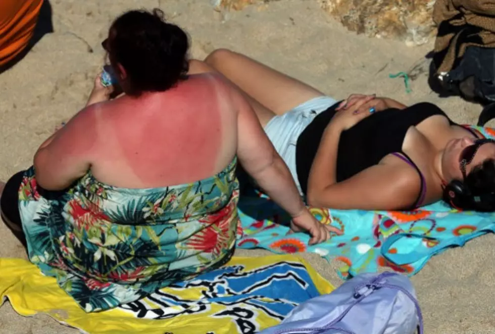 Sunburn Art: A Dangerous New Trend?