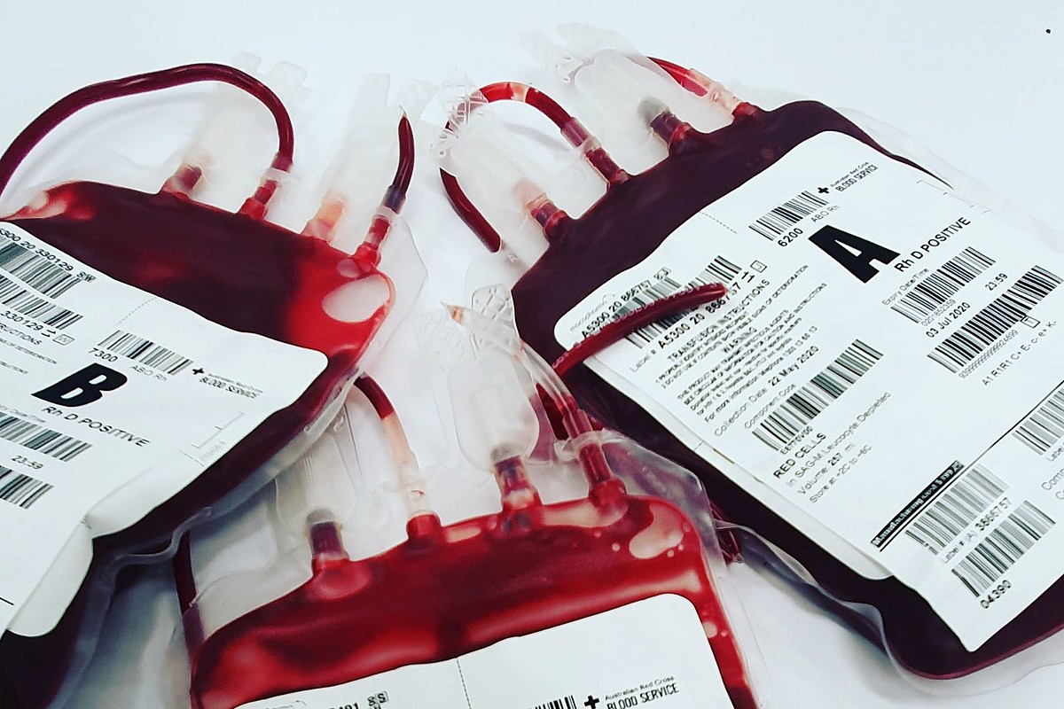 Донорство эритроцитов. Компоненты крови для переливания. Менеджмент крови.